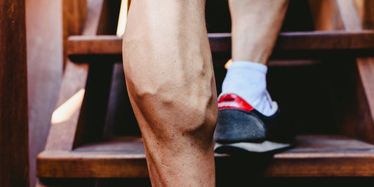 Krampfadern und Fitness – wie wir ihnen vorbeugen können